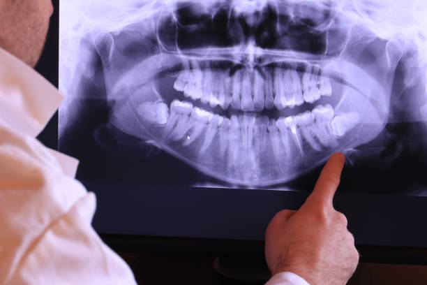 Best Tooth Infection Emergency Dentist  in Harlan, KY